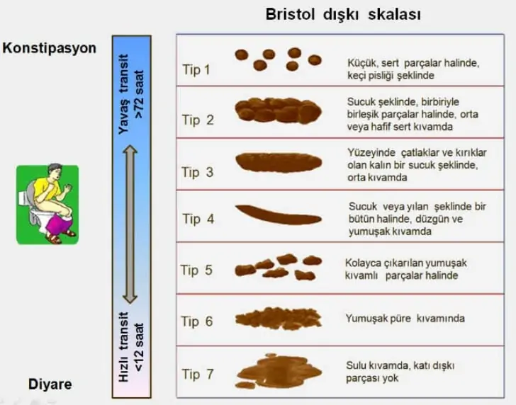 Bristol kaka tablosu bosaltim sistemi gastroenteroloji