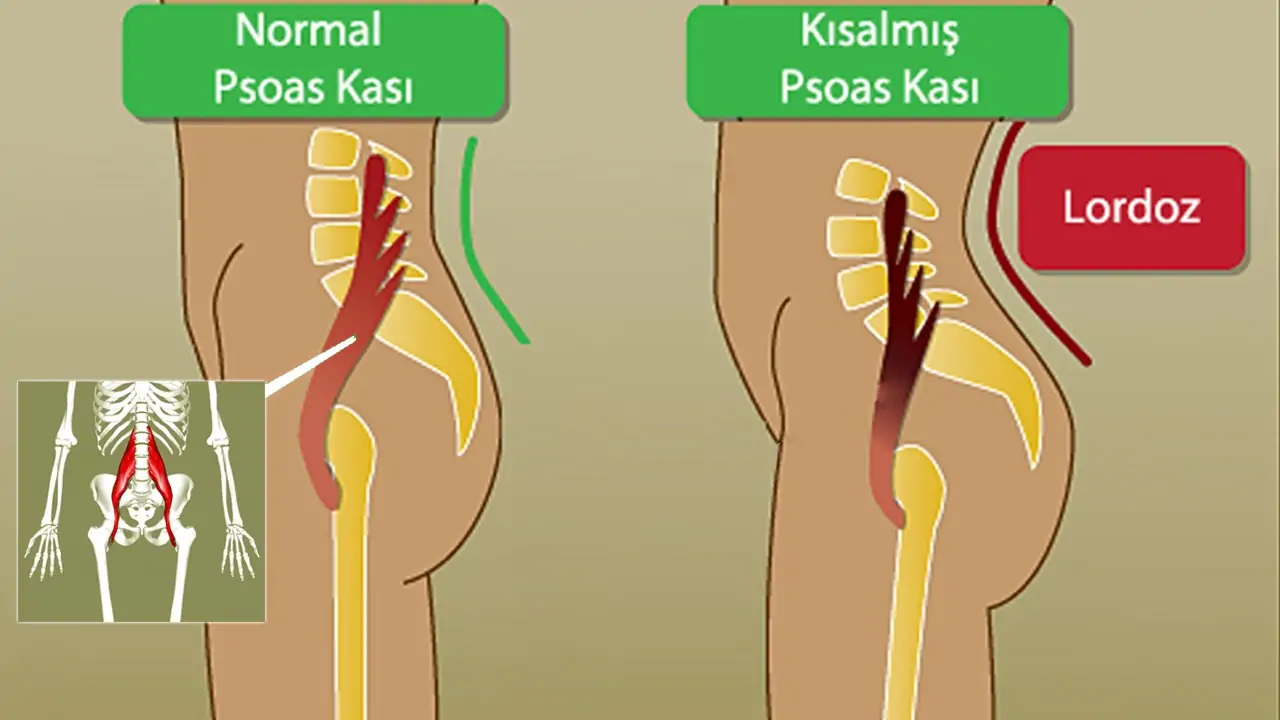 Psoas kası